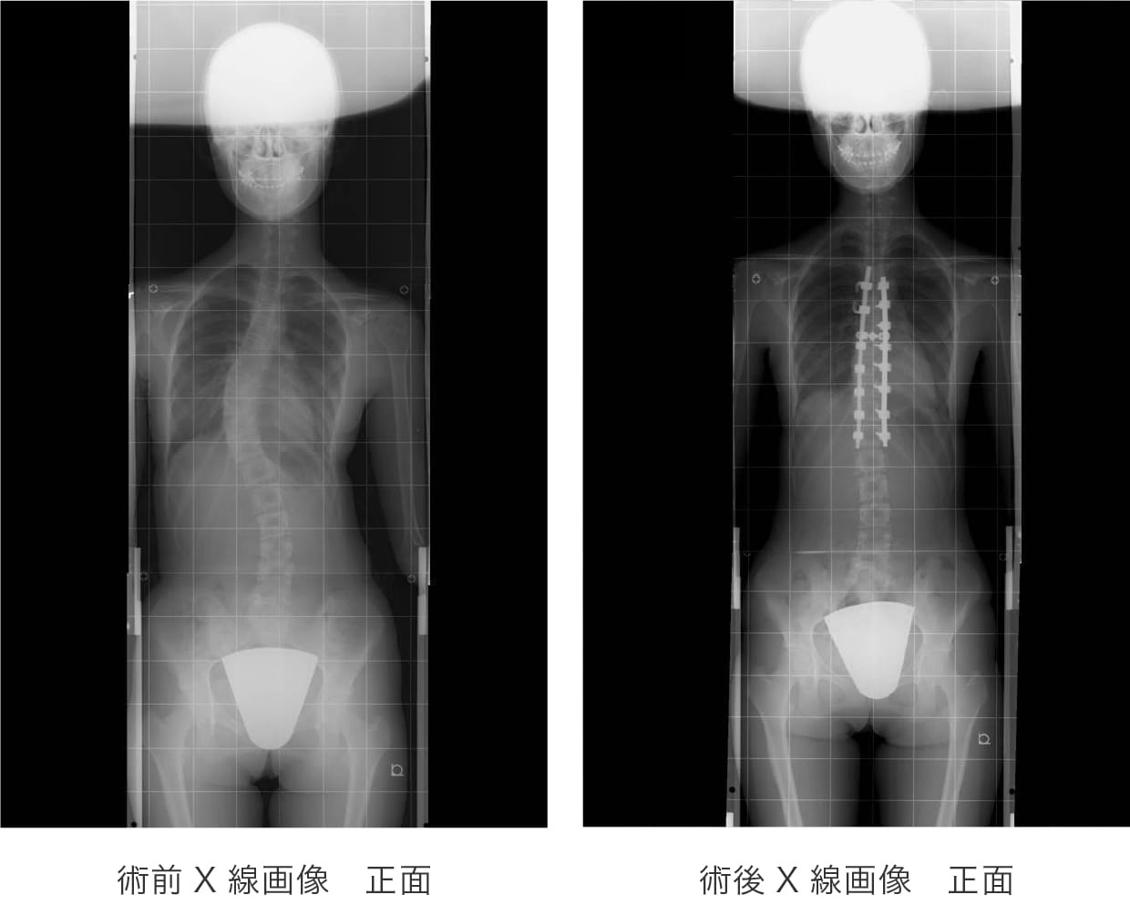 症例画像１