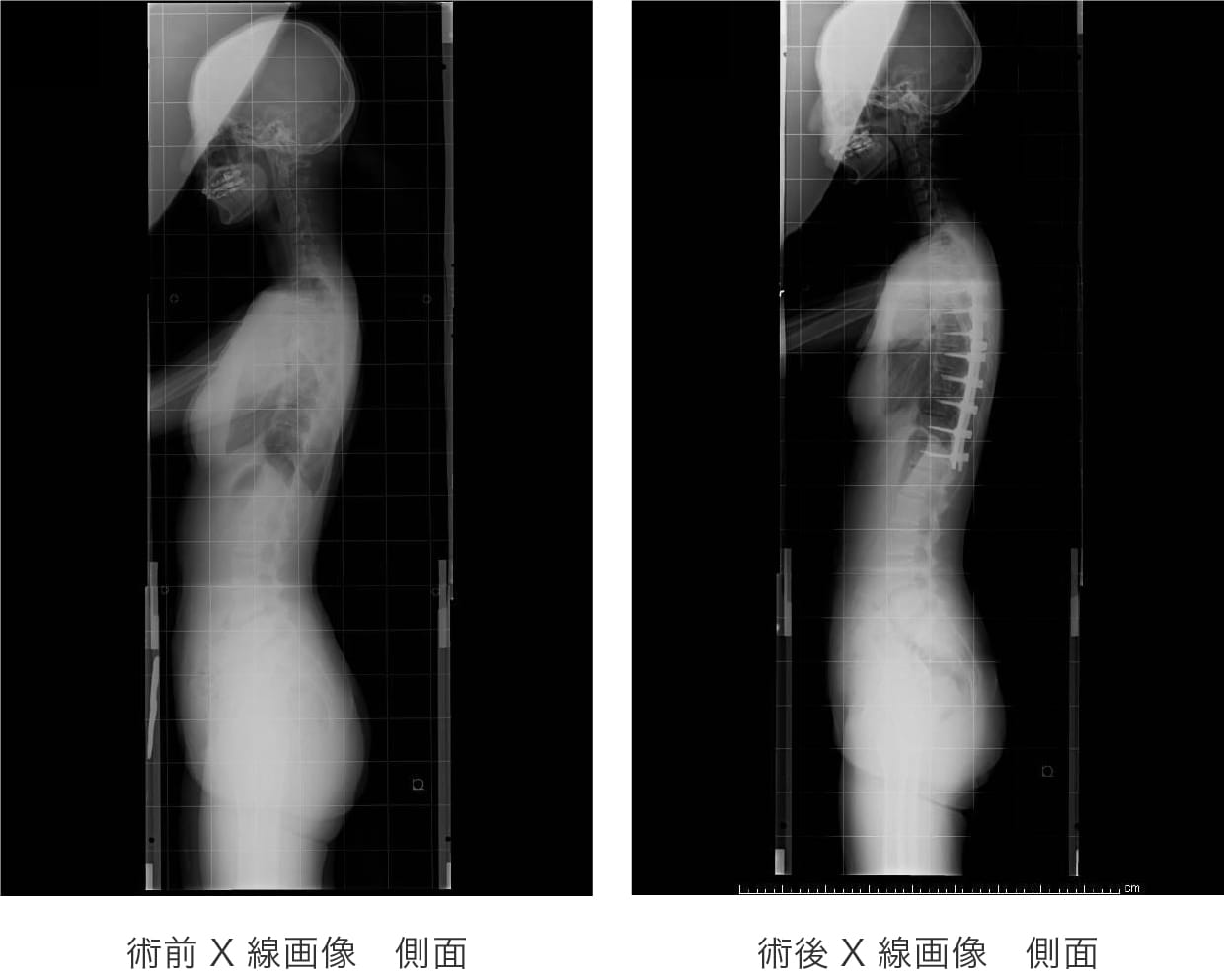 脊椎班(脊椎疾患)| 昭和大学藤が丘病院整形外科(横浜市青葉区) 脊椎班(脊椎疾患)| 昭和大学藤が丘病院整形外科(横浜市青葉区)