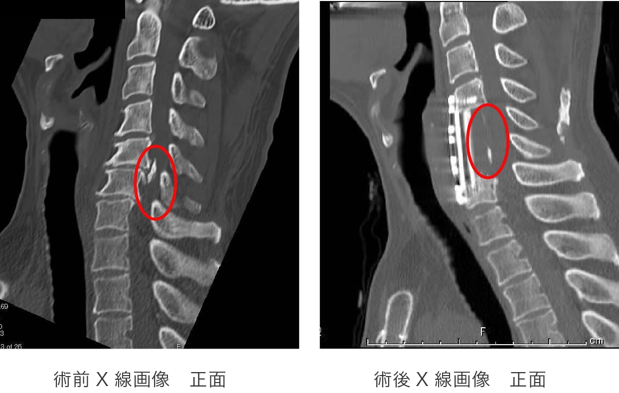 症例画像8