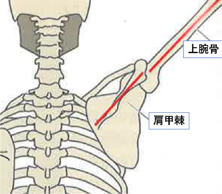 足関節インピンジメント症候群手術前