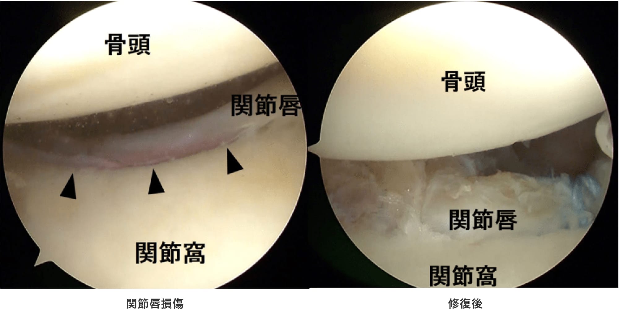 治療