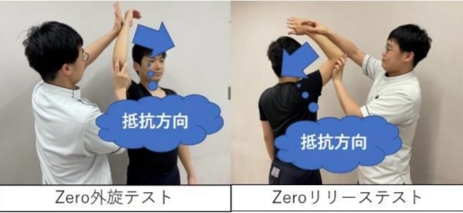 治療画像